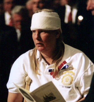 Chief Tobin with a bandage on her head